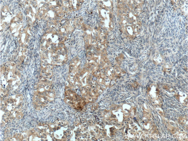 NRF2/NFE2L2 Antibody in Immunohistochemistry (Paraffin) (IHC (P))