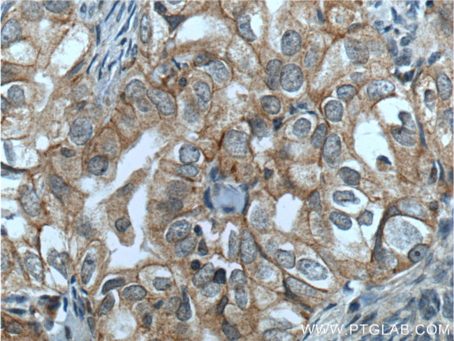 NRF2/NFE2L2 Antibody in Immunohistochemistry (Paraffin) (IHC (P))