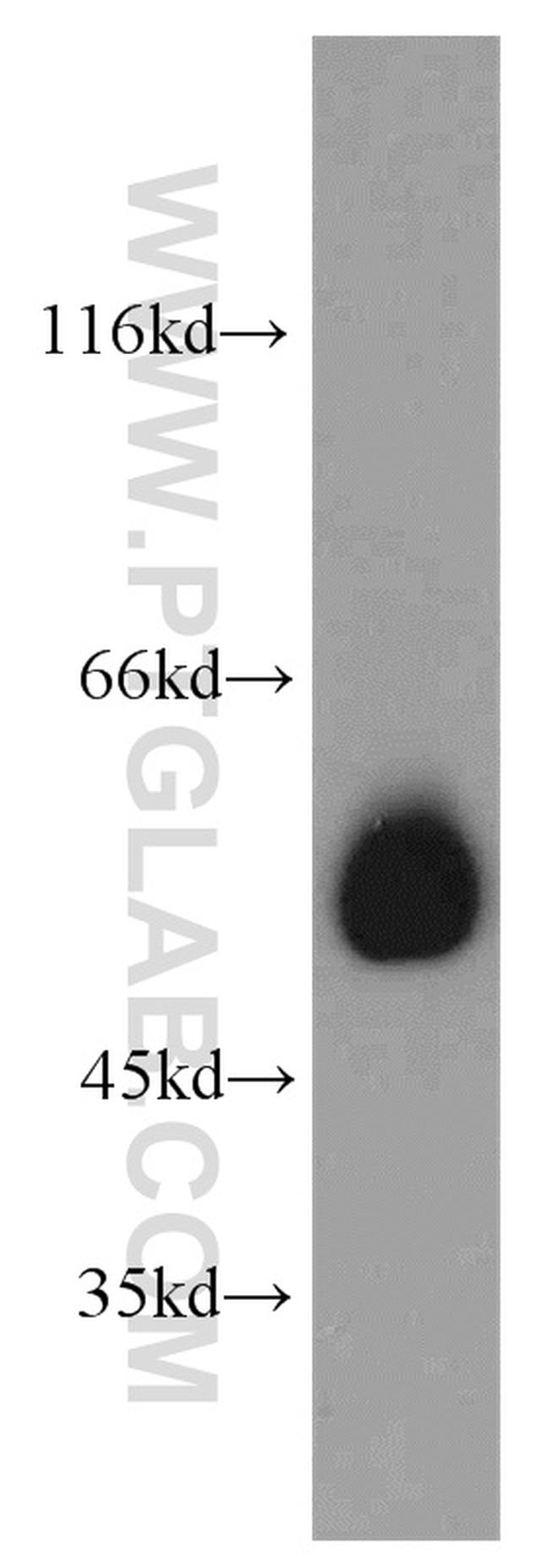 SMAD9 Antibody in Western Blot (WB)