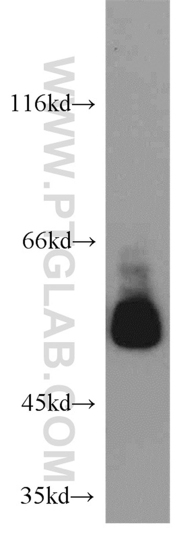 SMAD9 Antibody in Western Blot (WB)