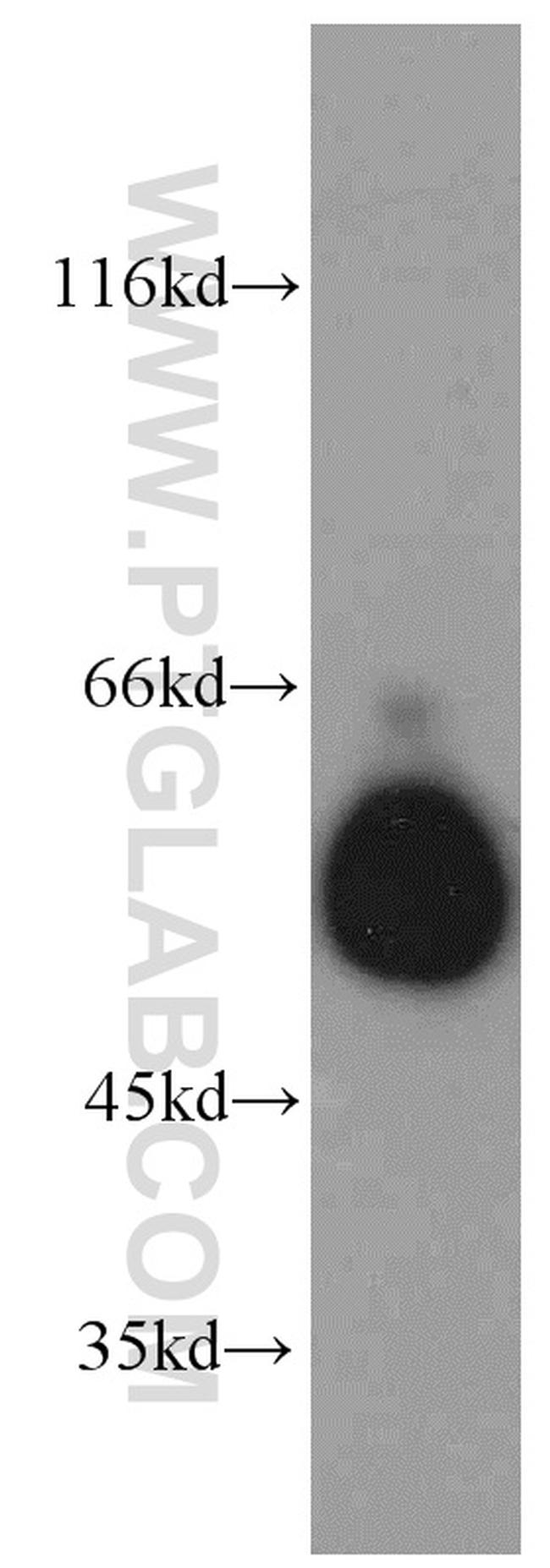 SMAD9 Antibody in Western Blot (WB)