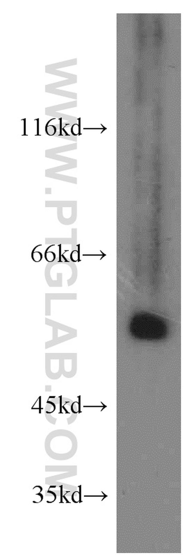 SMAD9 Antibody in Western Blot (WB)