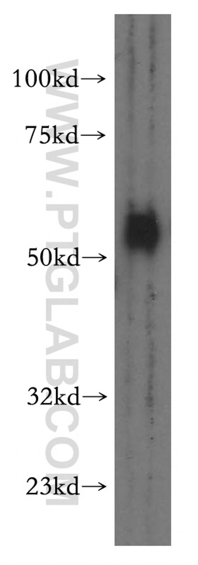 SMAD9 Antibody in Western Blot (WB)