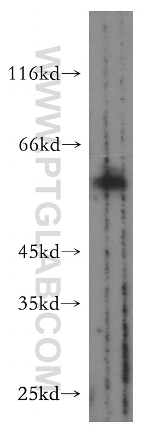 SMAD9 Antibody in Western Blot (WB)