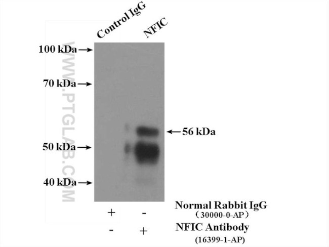 NFIC Antibody in Immunoprecipitation (IP)