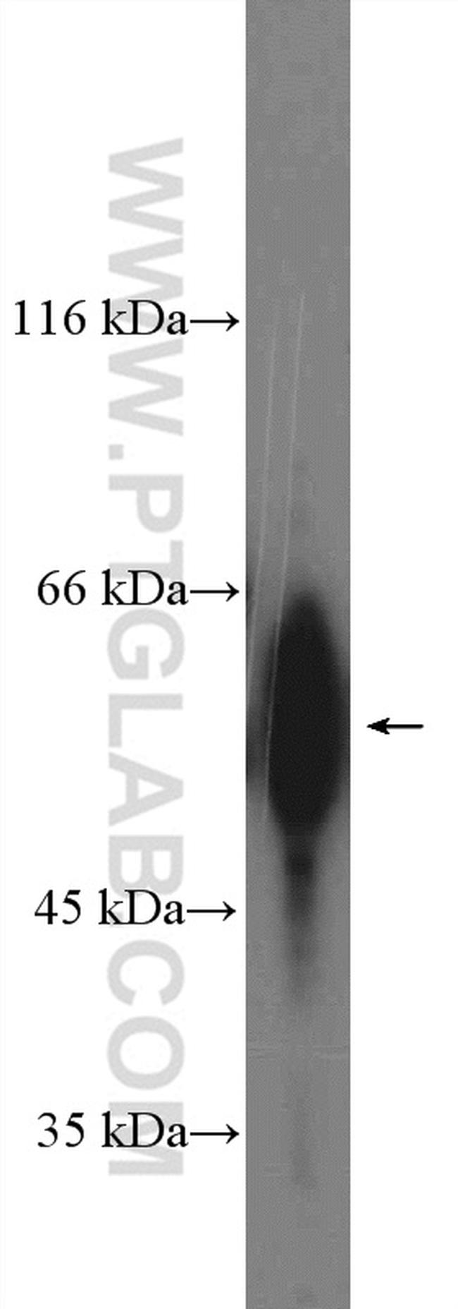 NFIC Antibody in Western Blot (WB)