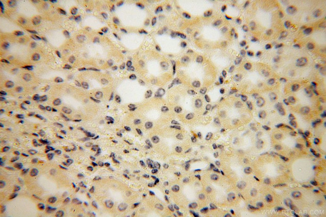 PISD Antibody in Immunohistochemistry (Paraffin) (IHC (P))