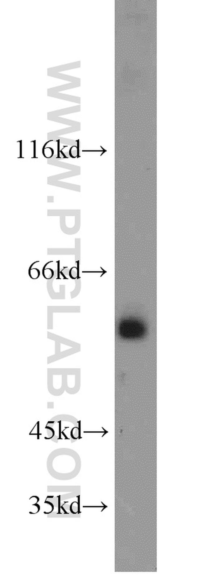 PISD Antibody in Western Blot (WB)