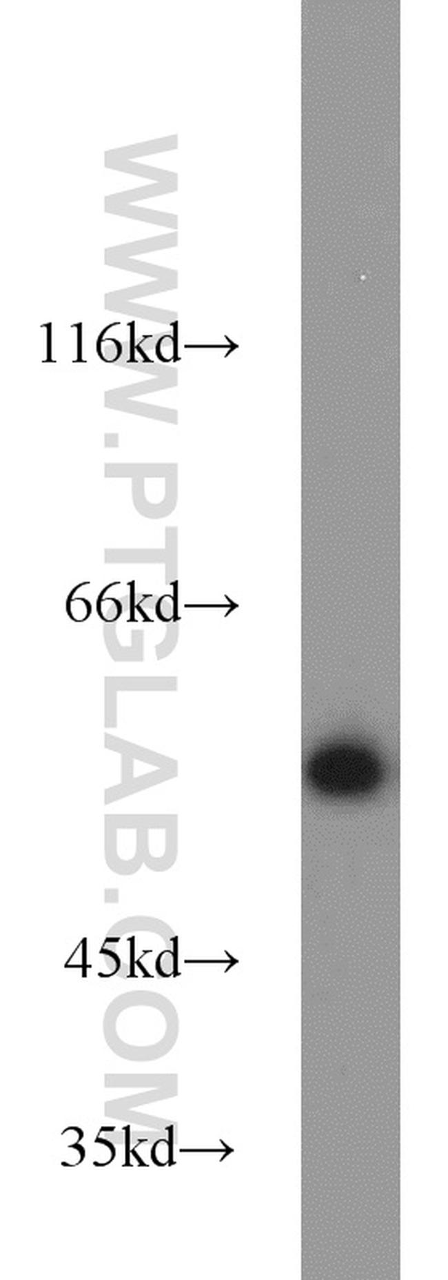 PISD Antibody in Western Blot (WB)