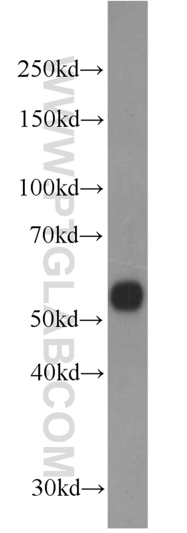 PISD Antibody in Western Blot (WB)