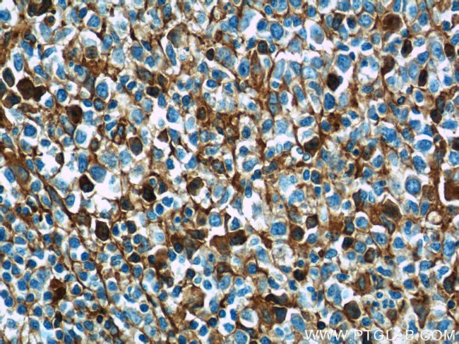 human IgG heavy chain Antibody in Immunohistochemistry (Paraffin) (IHC (P))