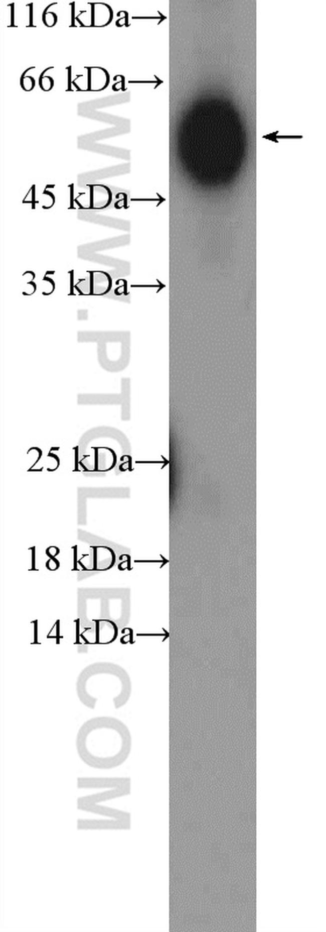 human IgG heavy chain Antibody in Western Blot (WB)