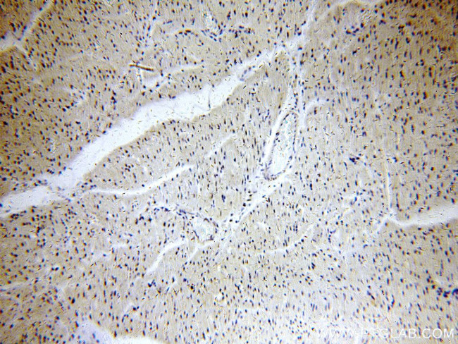 POLR2J Antibody in Immunohistochemistry (Paraffin) (IHC (P))