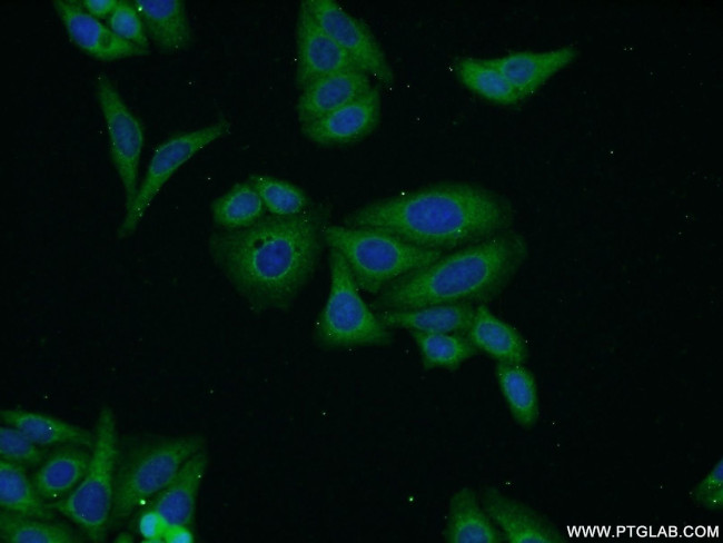 Biglycan Antibody in Immunocytochemistry (ICC/IF)