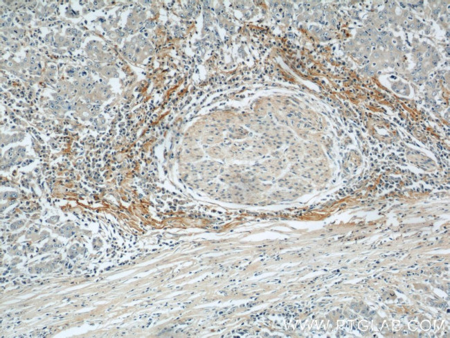 Biglycan Antibody in Immunohistochemistry (Paraffin) (IHC (P))