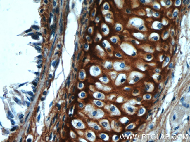 Biglycan Antibody in Immunohistochemistry (Paraffin) (IHC (P))