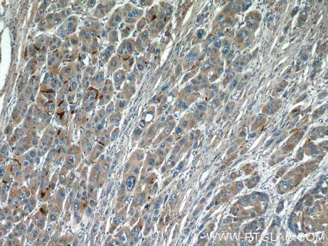 Biglycan Antibody in Immunohistochemistry (Paraffin) (IHC (P))