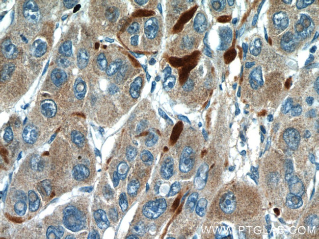 Biglycan Antibody in Immunohistochemistry (Paraffin) (IHC (P))