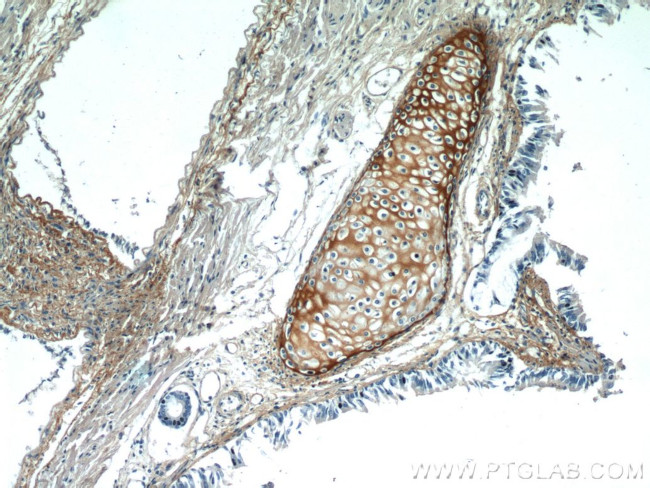 Biglycan Antibody in Immunohistochemistry (Paraffin) (IHC (P))