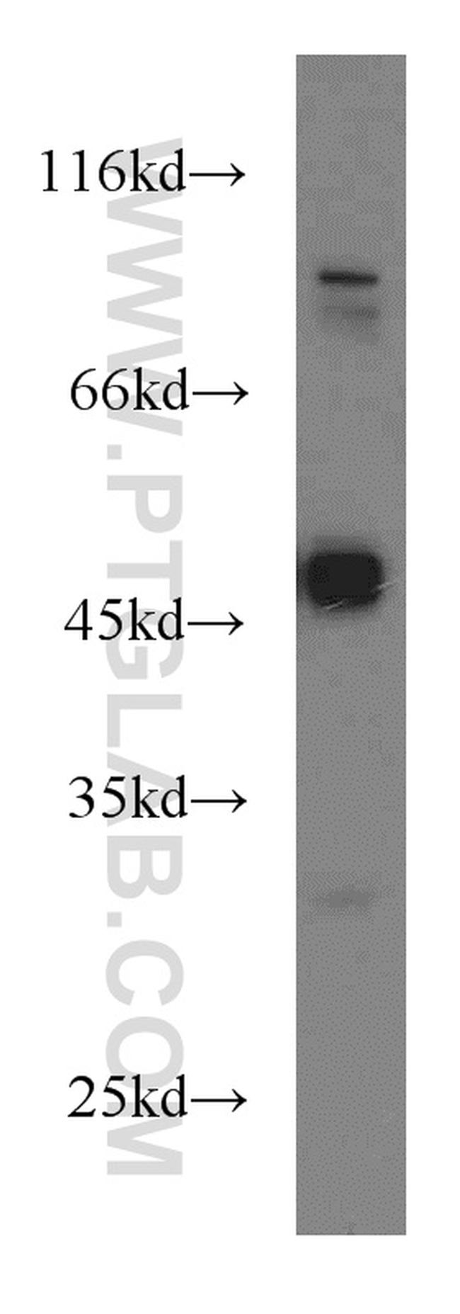 Biglycan Antibody in Western Blot (WB)