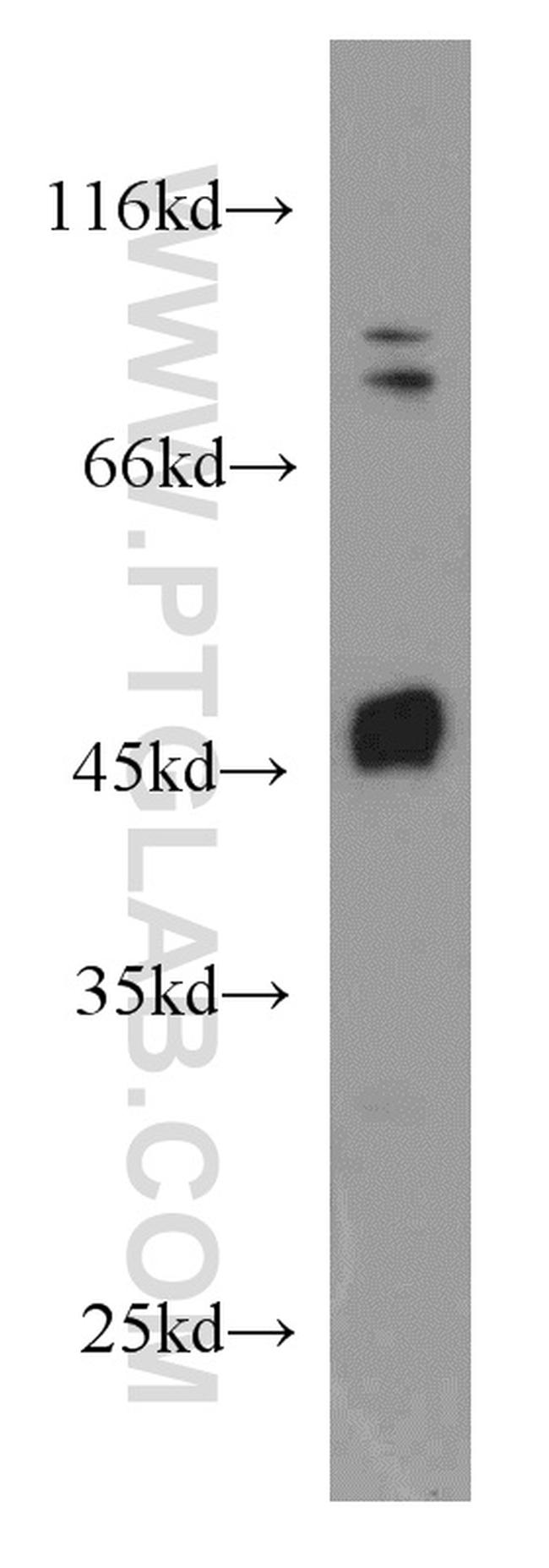 Biglycan Antibody in Western Blot (WB)