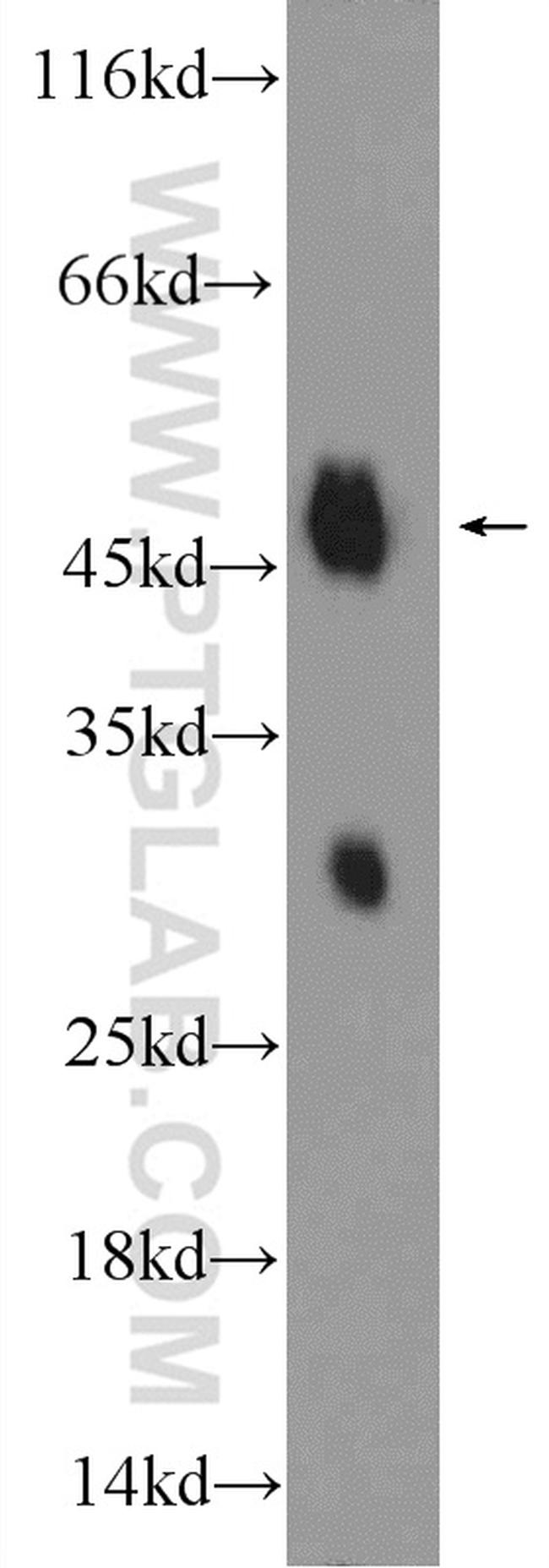 Biglycan Antibody in Western Blot (WB)