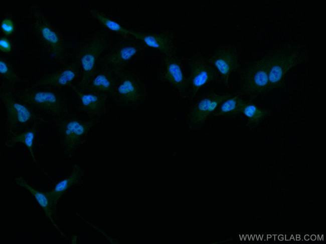 TYK2 Antibody in Immunocytochemistry (ICC/IF)