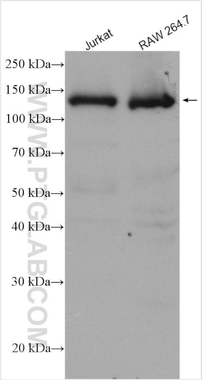 TYK2 Antibody in Western Blot (WB)