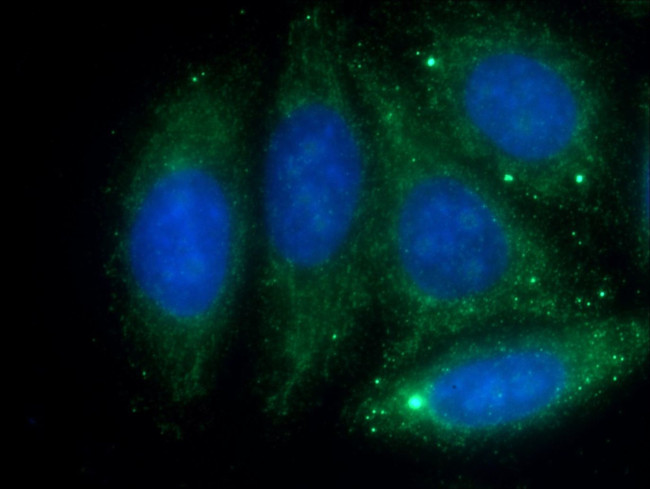 Antithrombin III Antibody in Immunocytochemistry (ICC/IF)