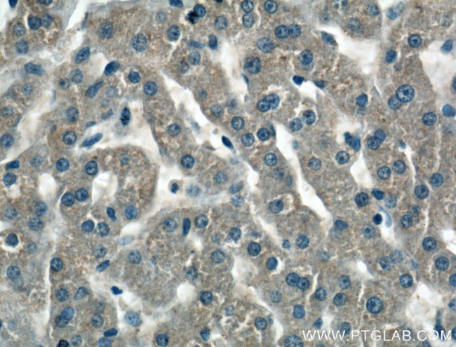 Antithrombin III Antibody in Immunohistochemistry (Paraffin) (IHC (P))