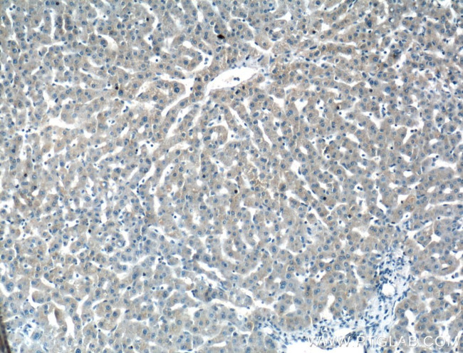 Antithrombin III Antibody in Immunohistochemistry (Paraffin) (IHC (P))