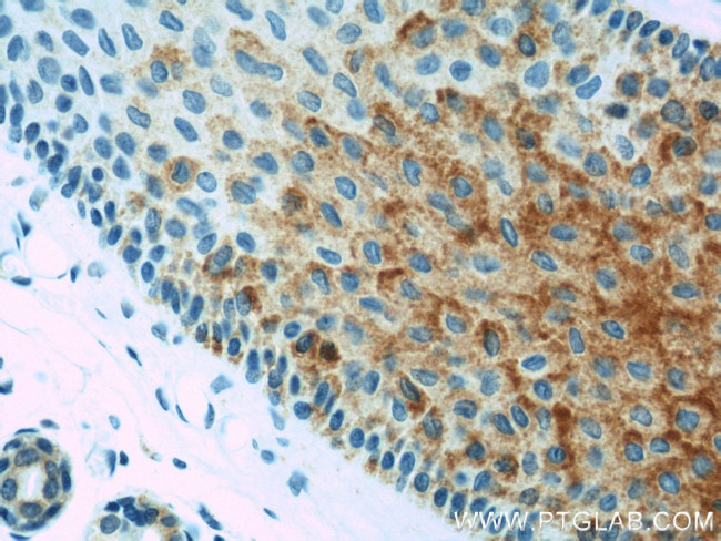 BCAT2 Antibody in Immunohistochemistry (Paraffin) (IHC (P))