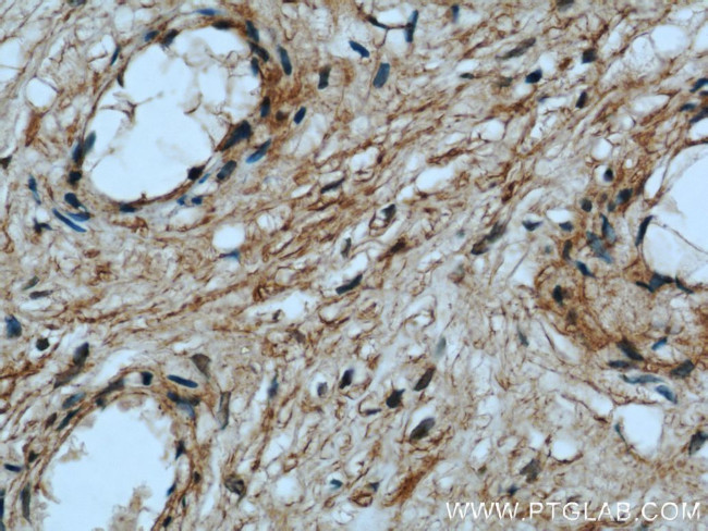 BCAT2 Antibody in Immunohistochemistry (Paraffin) (IHC (P))