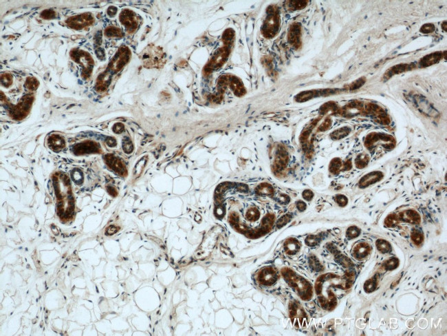 BCAT2 Antibody in Immunohistochemistry (Paraffin) (IHC (P))