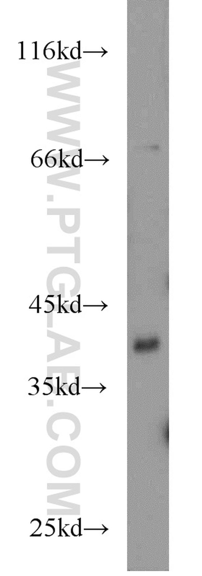 BCAT2 Antibody in Western Blot (WB)