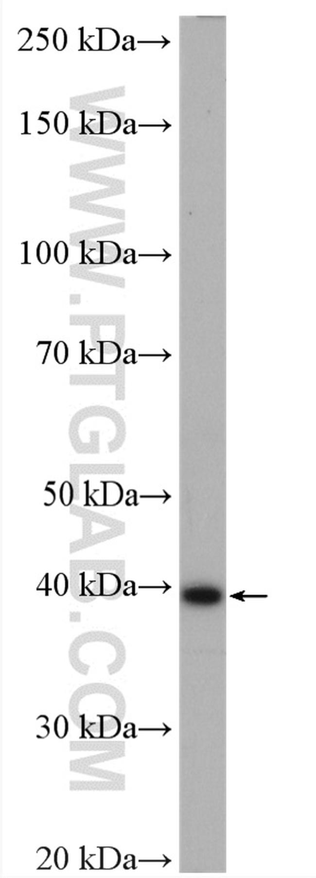 BCAT2 Antibody in Western Blot (WB)