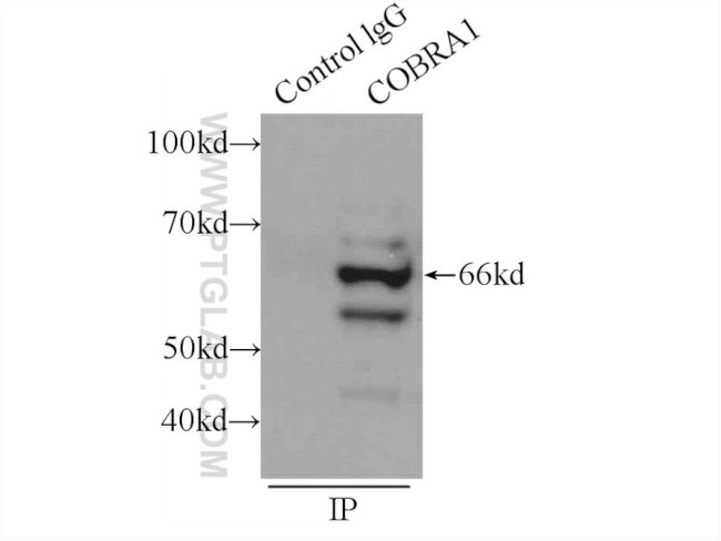 NELFB Antibody in Immunoprecipitation (IP)