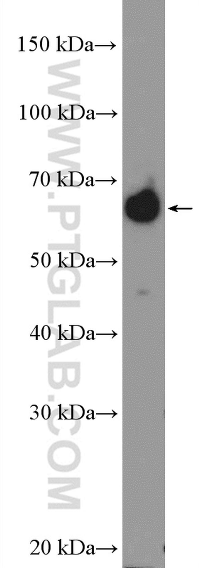 NELFB Antibody in Western Blot (WB)