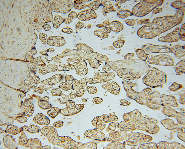 FUCA1 Antibody in Immunohistochemistry (Paraffin) (IHC (P))