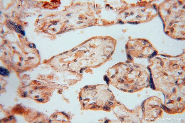 FUCA1 Antibody in Immunohistochemistry (Paraffin) (IHC (P))