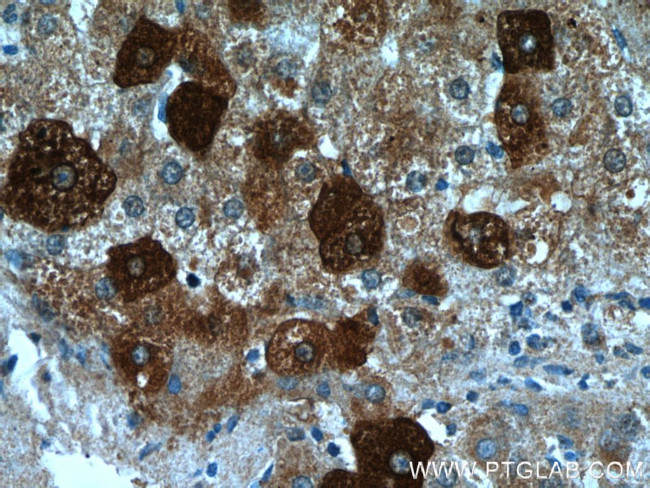 FUCA1 Antibody in Immunohistochemistry (Paraffin) (IHC (P))