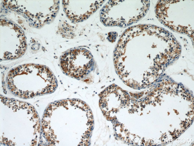 FUCA1 Antibody in Immunohistochemistry (Paraffin) (IHC (P))