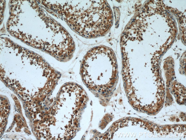 FUCA1 Antibody in Immunohistochemistry (Paraffin) (IHC (P))