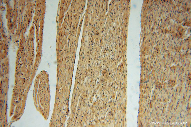 FUCA1 Antibody in Immunohistochemistry (Paraffin) (IHC (P))