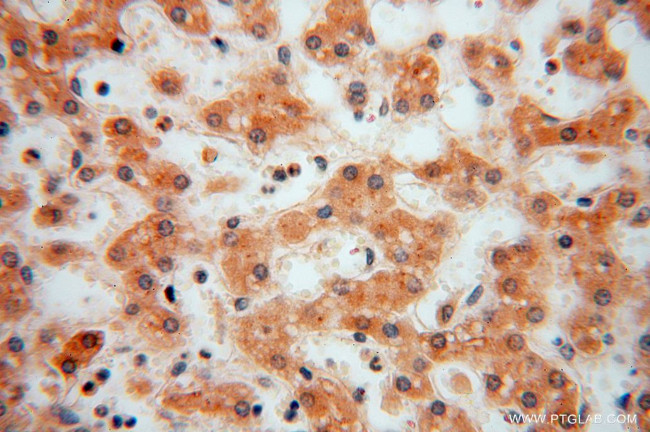 FUCA1 Antibody in Immunohistochemistry (Paraffin) (IHC (P))