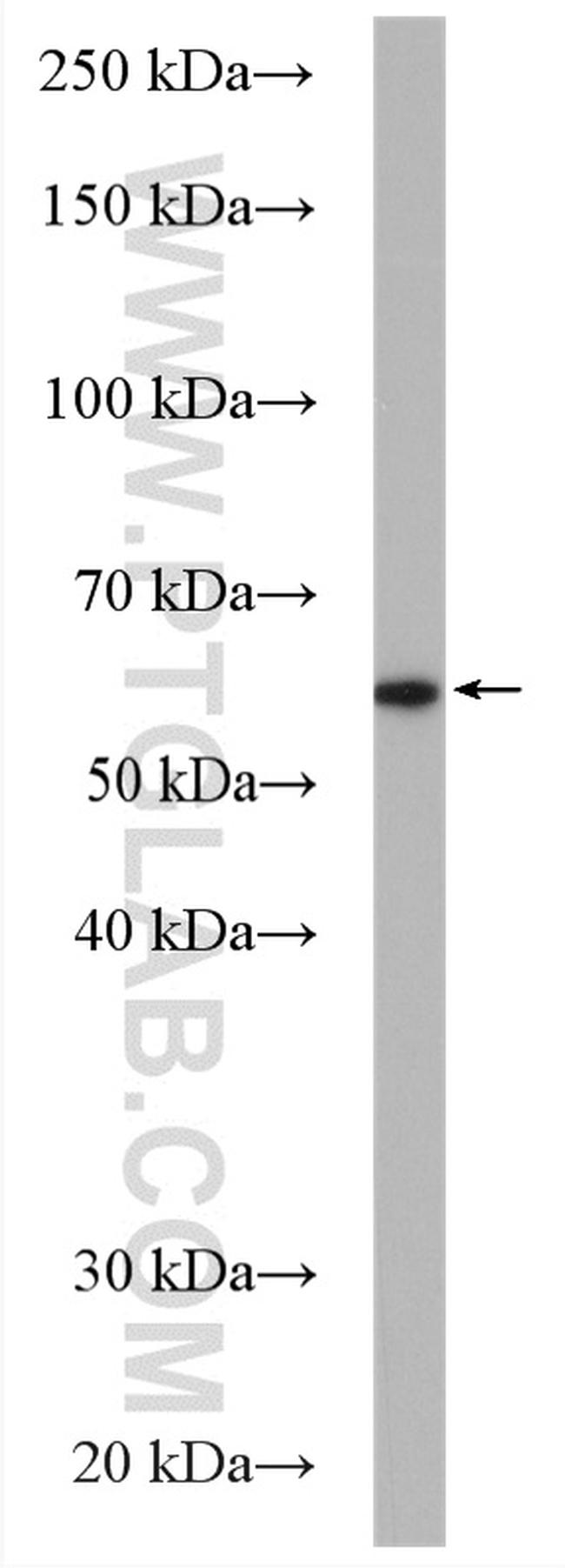 FUCA1 Antibody in Western Blot (WB)