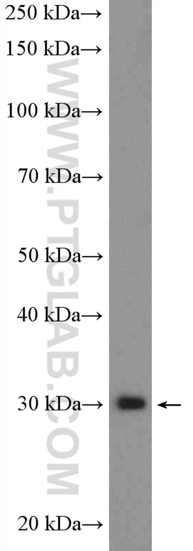 POLR3H Antibody in Western Blot (WB)