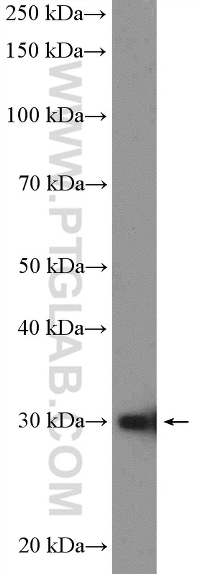 POLR3H Antibody in Western Blot (WB)