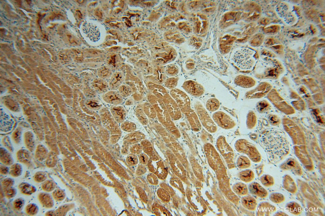 CHMP7 Antibody in Immunohistochemistry (Paraffin) (IHC (P))