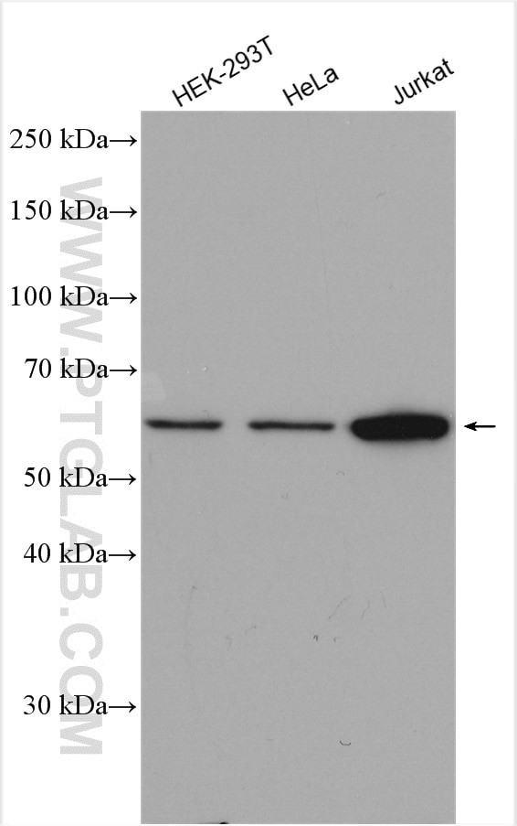 CHMP7 Antibody in Western Blot (WB)